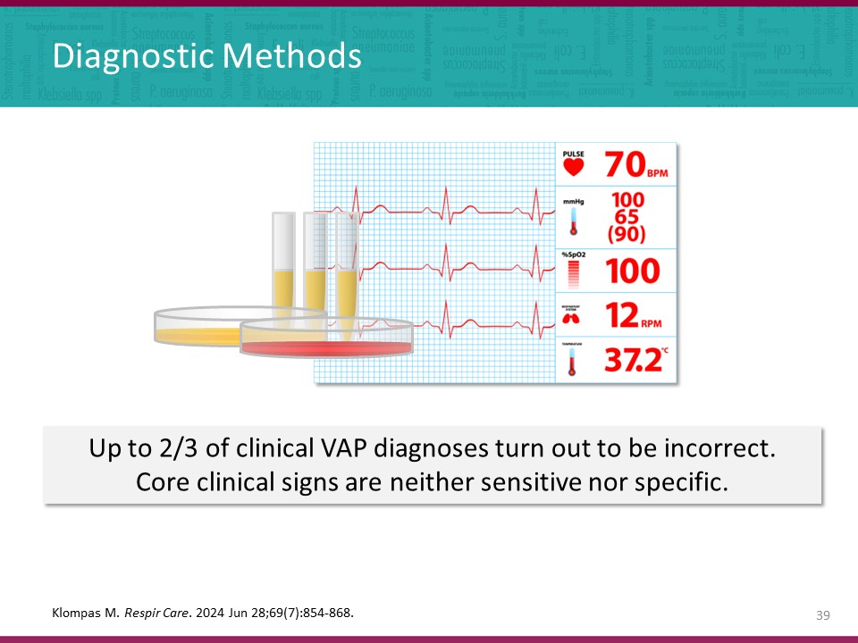 tronconneuse vap 553s Electrocardiographe ECG KardiaMobile